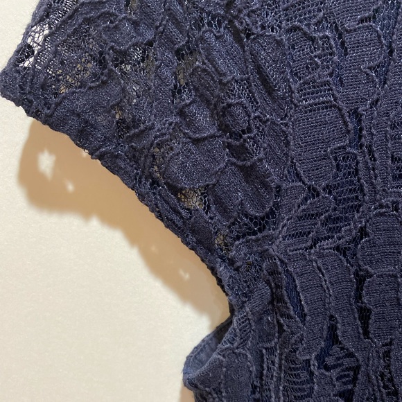 ONLY lace cocktail dress - Picture 2 of 6